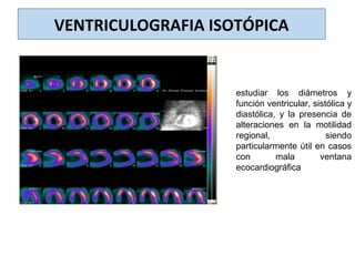 VENTRICULOGRAFIA ISOTÓPICA
estudiar los diámetros y
función ventricular, sistólica y
diastólica, y la presencia de
alteraciones en la motilidad
regional, siendo
particularmente útil en casos
con mala ventana
ecocardiográfica
 