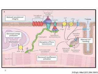 N Engl J Med 2011;364:1643-5

 