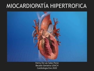 MIOCARDIOPATÍA HIPERTROFICA
Henry De Las Salas Perez
Becado Geriatria USACH
Cardiologia Ene 2020
 