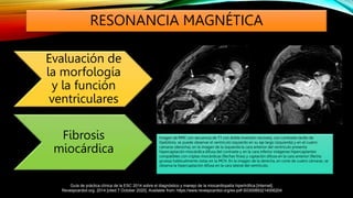 Miocardiopatía hipertrófica- Cardiologia.pptx
