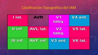 Clasificación Topográfica del IAM 
 