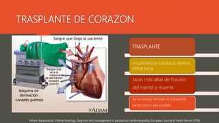 TRASPLANTE DE CORAZON
Johann Bauersachs1, Pathophysiology, diagnosis and management of peripartum cardiomyopathy, European Journal of Heart Failure (2019)
TRASPLANTE
insuficiencia cardíaca severa
refractaria
tasas más altas de fracaso
del injerto y muerte
Se aconseja retrasar el trasplante
tanto como sea posible
 