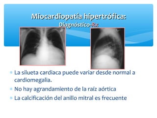 Miocardiopatía hipertrófica:Miocardiopatía hipertrófica:
Diagnóstico-Diagnóstico-RxRx
∗ La silueta cardiaca puede variar desde normal a
cardiomegalia.
∗ No hay agrandamiento de la raíz aórtica
∗ La calcificación del anillo mitral es frecuente
 