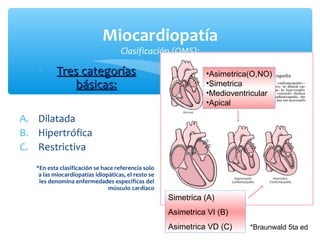 Miocardiopatía
Clasificación (OMS):
∗ Tres categoríasTres categorías
básicas:básicas:
A. Dilatada
B. Hipertrófica
C. Restrictiva
*En esta clasificación se hace referencia solo
a las miocardiopatías idiopáticas, el resto se
les denomina enfermedades especificas del
músculo cardiaco
*Braunwald 5ta ed
•Asimetrica(O,NO)
•Simetrica
•Medioventricular
•Apical
Simetrica (A)
Asimetrica VI (B)
Asimetrica VD (C)
 