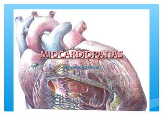 MIOCARDIOPATIASMIOCARDIOPATIAS
Una visión generalUna visión general
 