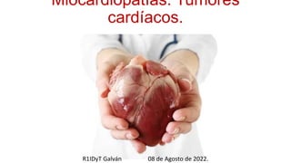 Miocardiopatías. Tumores
cardíacos.
R1IDyT Galván 08 de Agosto de 2022.
 