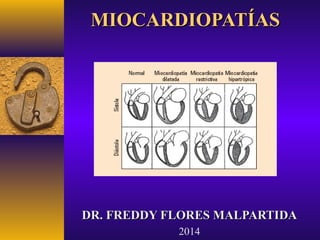 MIOCARDIOPATÍAS

DR. FREDDY FLORES MALPARTIDA
2014

 