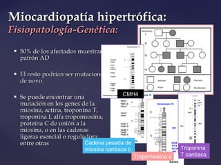 Miocardiopatias | PPT
