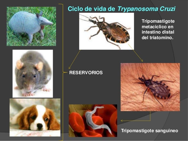 Miocarditis