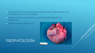 ETIOPATOGENIA
 Miocarditis eosinofilica
 Origen alérgico
 Eosinofilia en sangre periférica
 Miocarditis en enfermedade...