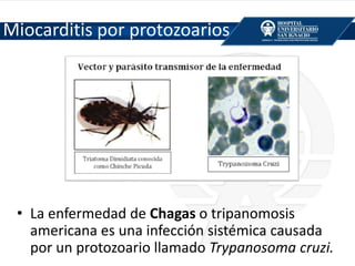 Miocarditis por protozoarios
• La enfermedad de Chagas o tripanomosis
americana es una infección sistémica causada
por un protozoario llamado Trypanosoma cruzi.
Guadalajara, J.F. (2012) Cardiología. Méndez Editores. 7ª edición. Pp. 745-773; 1003-1019, México.
 