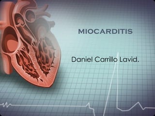 miocarditis


Daniel Carrillo Lavid.
 