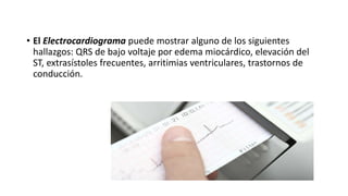 • El Electrocardiograma puede mostrar alguno de los siguientes
hallazgos: QRS de bajo voltaje por edema miocárdico, elevación del
ST, extrasístoles frecuentes, arritimias ventriculares, trastornos de
conducción.
 