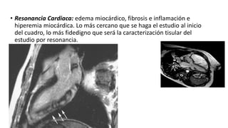 • Resonancia Cardiaca: edema miocárdico, fibrosis e inflamación e
hiperemia miocárdica. Lo más cercano que se haga el estudio al inicio
del cuadro, lo más fidedigno que será la caracterización tisular del
estudio por resonancia.
 