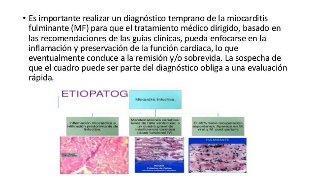 Miocarditis Fulminante