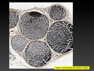TIBIAL POSTERIOR DE PERRO (400X)
 