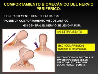 COMPORTAMIENTO BIOMECÁNICO DEL NERVIO
            PERIFÉRICO.
•CONSTANTEMENTE SOMETIDO A CARGAS.
•POSEE UN COMPORTAMIENTO VISCOELÁSTICO.
           •EN GENERAL EL NERVIO SE LESIONA POR:

                                (A) ESTIRAMIENTO




                                 (B,C) COMPRESIÓN
                                 (Crónica o Traumática).


                                MAYOR INCIDENCIA EN ZONAS DE
                                MAYOR EXPOSICIÓN DE LOS
                                NERVIOS (PLEXO BRAQUIAL,
                                ULNAR, FIBULAR COMÚN).
 