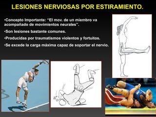 LESIONES NERVIOSAS POR ESTIRAMIENTO.

•Concepto Importante: “El mov. de un miembro va
acompañado de movimientos neurales”.
•Son lesiones bastante comunes.
•Producidas por traumatismos violentos y fortuitos.
•Se excede la carga máxima capaz de soportar el nervio.
 