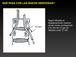 QUÉ PASA CON LAS RAÍCES NERVIOSAS?




                             Según Miralles el
                             desplazamiento máximo
                             de las raíces corresponde
                             a la raíz de L5 que se
                             deplaza unos 12 mm.
 