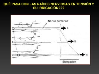 QUÉ PASA CON LAS RAÍCES NERVIOSAS EN TENSIÓN Y
               SU IRRIGACIÓN???
 