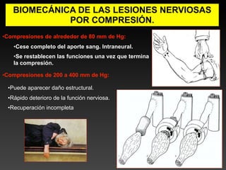 BIOMECÁNICA DE LAS LESIONES NERVIOSAS
             POR COMPRESIÓN.
•Compresiones de alrededor de 80 mm de Hg:
   •Cese completo del aporte sang. Intraneural.
   •Se restablecen las funciones una vez que termina
   la compresión.

•Compresiones de 200 a 400 mm de Hg:

 •Puede aparecer daño estructural.
 •Rápido deterioro de la función nerviosa.
 •Recuperación incompleta
 