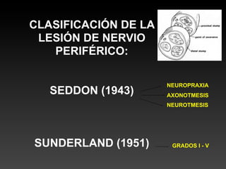 CLASIFICACIÓN DE LA
 LESIÓN DE NERVIO
   PERIFÉRICO:

                      NEUROPRAXIA
   SEDDON (1943)      AXONOTMESIS
                      NEUROTMESIS




SUNDERLAND (1951)      GRADOS I - V
 