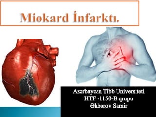 Miokard infarkti (Myocardia infarctus)