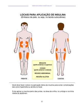 HIPERTENSÃO ARTERIAL E DIABETES MELLITUS




                  97
 