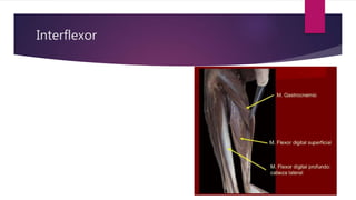 Interflexor
 