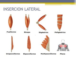 INSERCION LATERAL
 