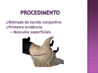 DIVISÃO DA MUSCULATURAQuanto aos Tipos de FibrasEstriado 