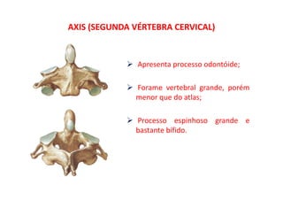 AXIS (SEGUNDA VÉRTEBRA CERVICAL)
Apresenta processo odontóide;
Forame vertebral grande, porém
menor que do atlas;q ;
Processo espinhoso grande eProcesso espinhoso grande e
bastante bífido.
 