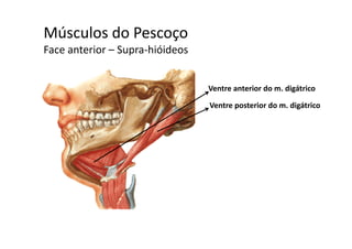 Músculos do Pescoçoç
Face anterior – Supra‐hióideos 
Ventre anterior do m. digátrico
Ventre posterior do m. digátrico
 
