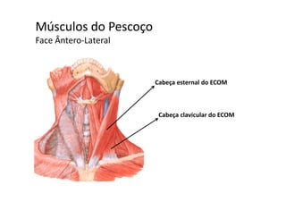 Músculos do Pescoçoç
Face Ântero‐Lateral
Cabeça esternal do ECOM
Cabeça clavicular do ECOM
 