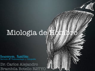Miologia de Hombro


Issemym, Satélite.
Servicio de Traumatología y Ortopedia

Dr. Carlos Alejandro
Brambila Botello R2TYO
 