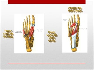 Flexor
Flexor
Corto del
Corto del
5to Dedo
5to Dedo
Flexor
Flexor
Corto del
Corto del
Dedo
Dedo
Gordo
Gordo
Aductor del
Aductor del
Dedo Gordo
Dedo Gordo
 