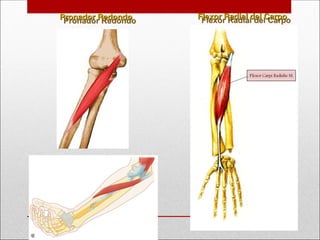 Pronador Redondo
Pronador Redondo Flexor Radial del Carpo
Flexor Radial del Carpo
 