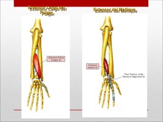 Extensor Largo del
Extensor Largo del
Pulgar
Pulgar
Extensor del Meñique
Extensor del Meñique
 