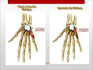 Flexor Corto del
Flexor Corto del
Meñique
Meñique
Oponente del Meñique
Oponente del Meñique
 