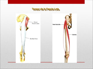Tensor de la Fascia Lata
Tensor de la Fascia Lata
 