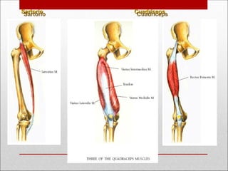 Sartorio
Sartorio Cuadriceps
Cuadriceps
 