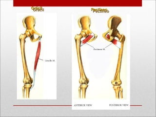 Pectíneo
Pectíneo
Grácil
Grácil
 