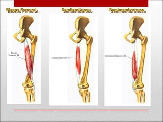 Semimembranoso
Semimembranoso
Semitendinoso
Semitendinoso
Bíceps Femoral
Bíceps Femoral
 