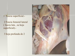 1  Fascia superficial.- 2 Fascia femoral lateral ( fascia lata , su hoja superficial).- 3 hoja profunda de 2 1 2 3 2 
