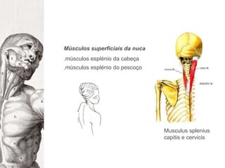 Músculos superficiais da nuca.músculos esplénio da cabeça .músculos esplénio do pescoço Musculusspleniuscapitis e cervicis