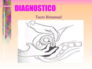 DIAGNOSTICO Tacto Bimanual 