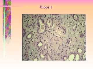 Biopsia 