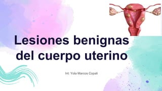 Lesiones benignas
del cuerpo uterino
Int: Yola Marcos Copali
 