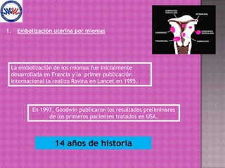 Embolización uterina por miomas La embolización de los miomas fue inicialmente desarrollada en Francia y la  primer publicación internacional la realizo Ravina en Lancet en 1995. En 1997, Goodwin publicaron los resultados preliminares de los primeros pacientes tratados en USA.  14 años de historia 
