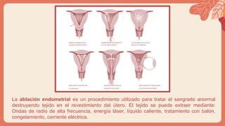 La ablación endometrial es un procedimiento utilizado para tratar el sangrado anormal
destruyendo tejido en el revestimiento del útero. El tejido se puede extraer mediante:
Ondas de radio de alta frecuencia, energía láser, líquido caliente, tratamiento con balón,
congelamiento, corriente eléctrica.
 